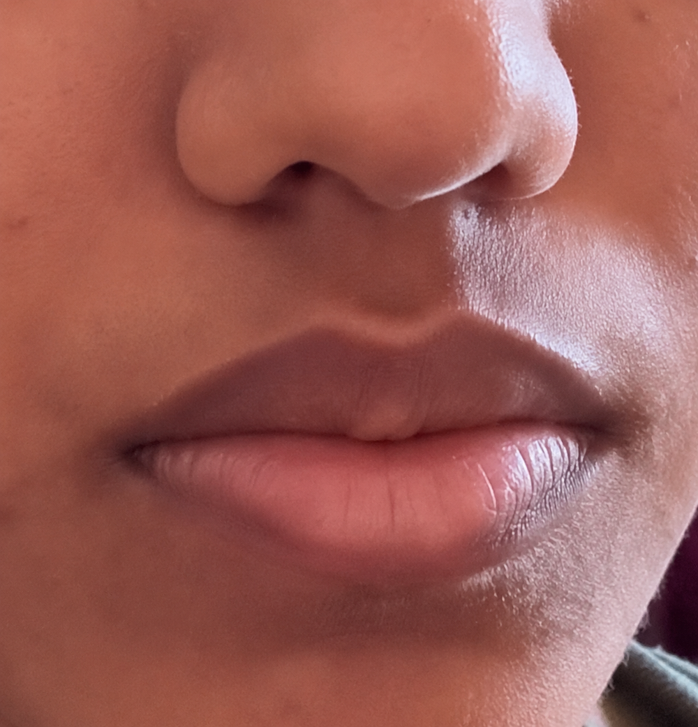 Before: second Soft Melt Overnight Lip Mask - Non Tinted result